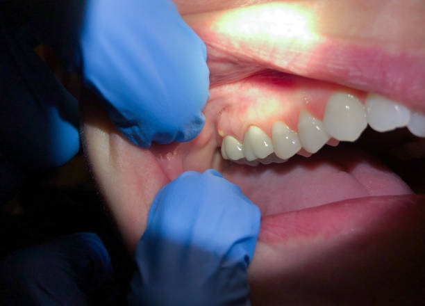 Best Mobile Emergency Dentist in Old Tappan, NJ