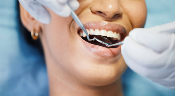 Best Emergency Root Canal Treatment in Old Tappan, NJ