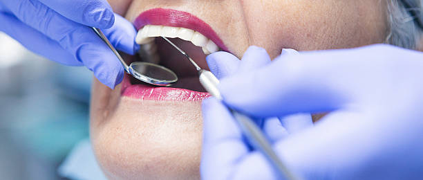 Best Emergency Dental Care for Abscessed Tooth in Old Tappan, NJ